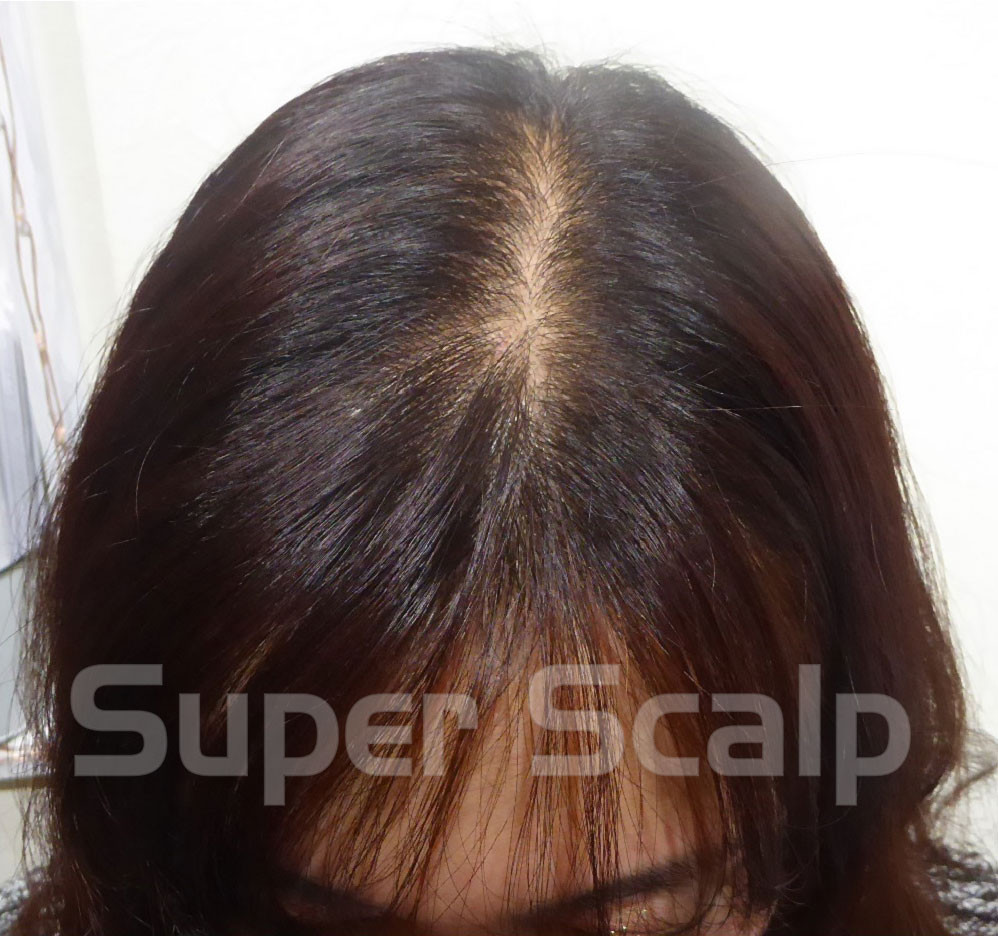 白髪染め、おしゃれ染め、発毛と薄毛にダメって本当？どうやって白髪を隠すの？