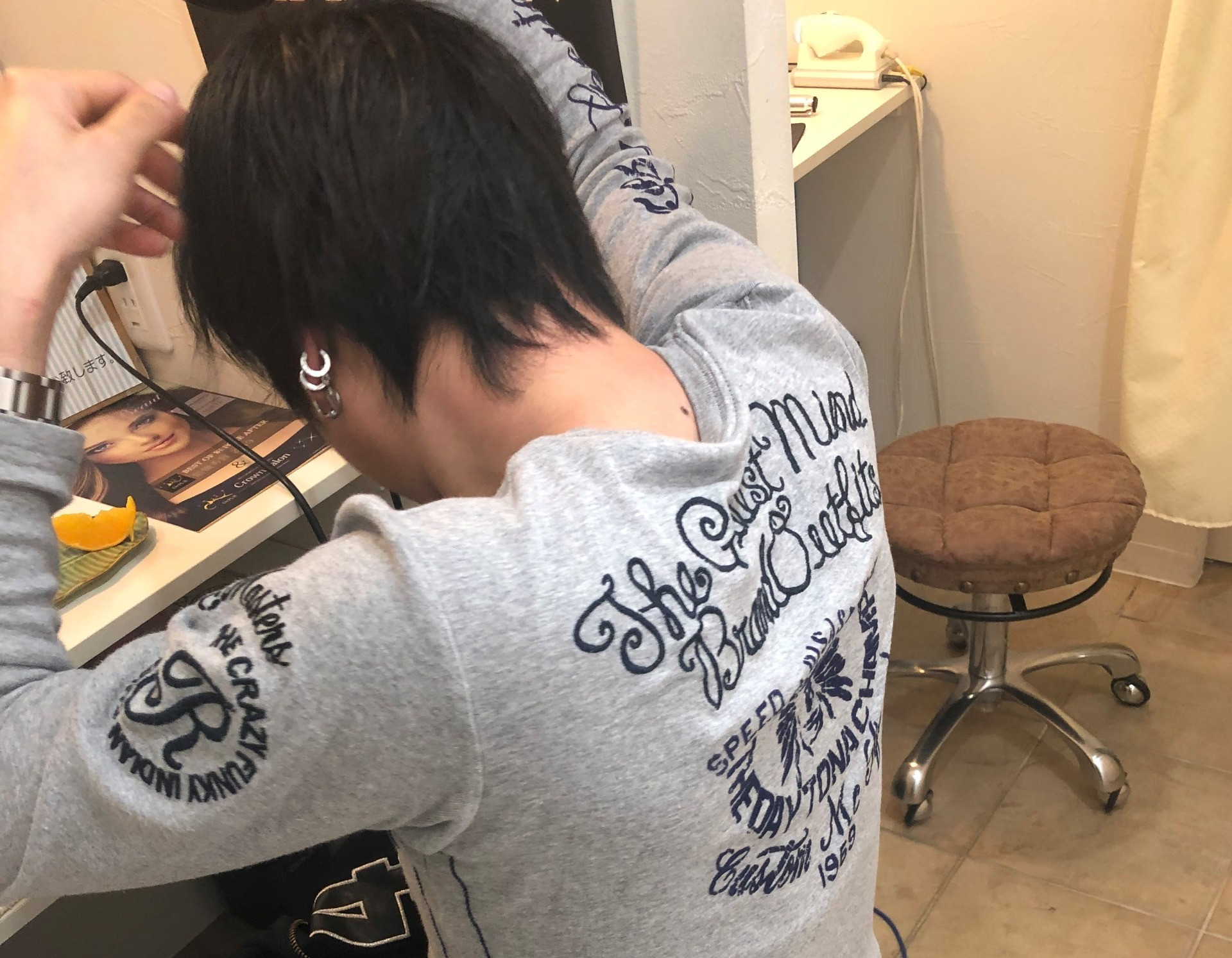 M字発毛と血管の因果関係　30歳の薄毛はお薬服用無しでも治療可能