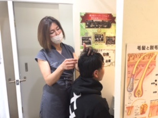 M字克服　難易度高い発毛で薄毛を克服した元美容師の20代