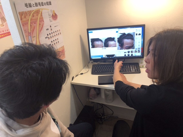 20歳の発毛治療 若さゆえ今なら間に合うアンチ薬の発毛テクニックとは