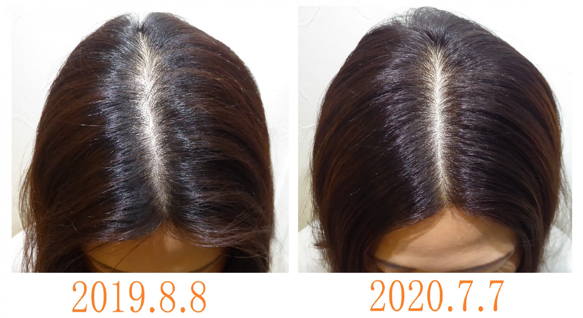 分け目が気になって好きな髪形が出来なかった